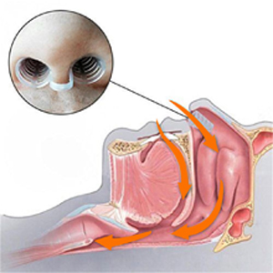 anti snoring devices for women