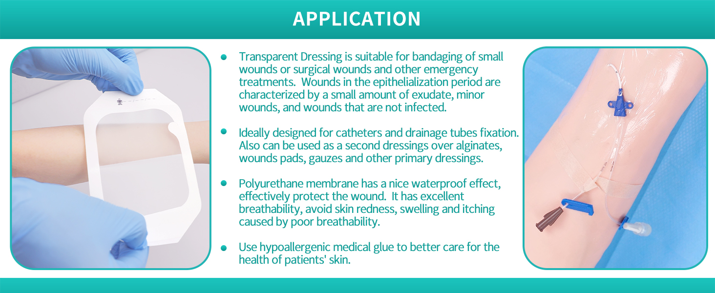 transparent film dressing
