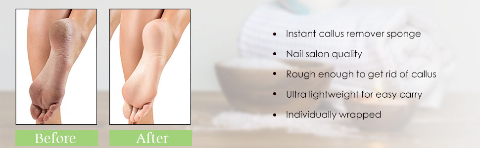 FOOT PUMICE