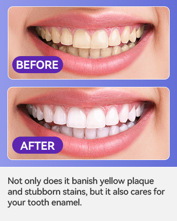 Teeth Whitening Strips