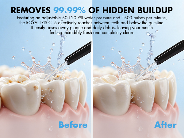 power dental flossers
