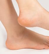 Electric Foot File and Callus Remover