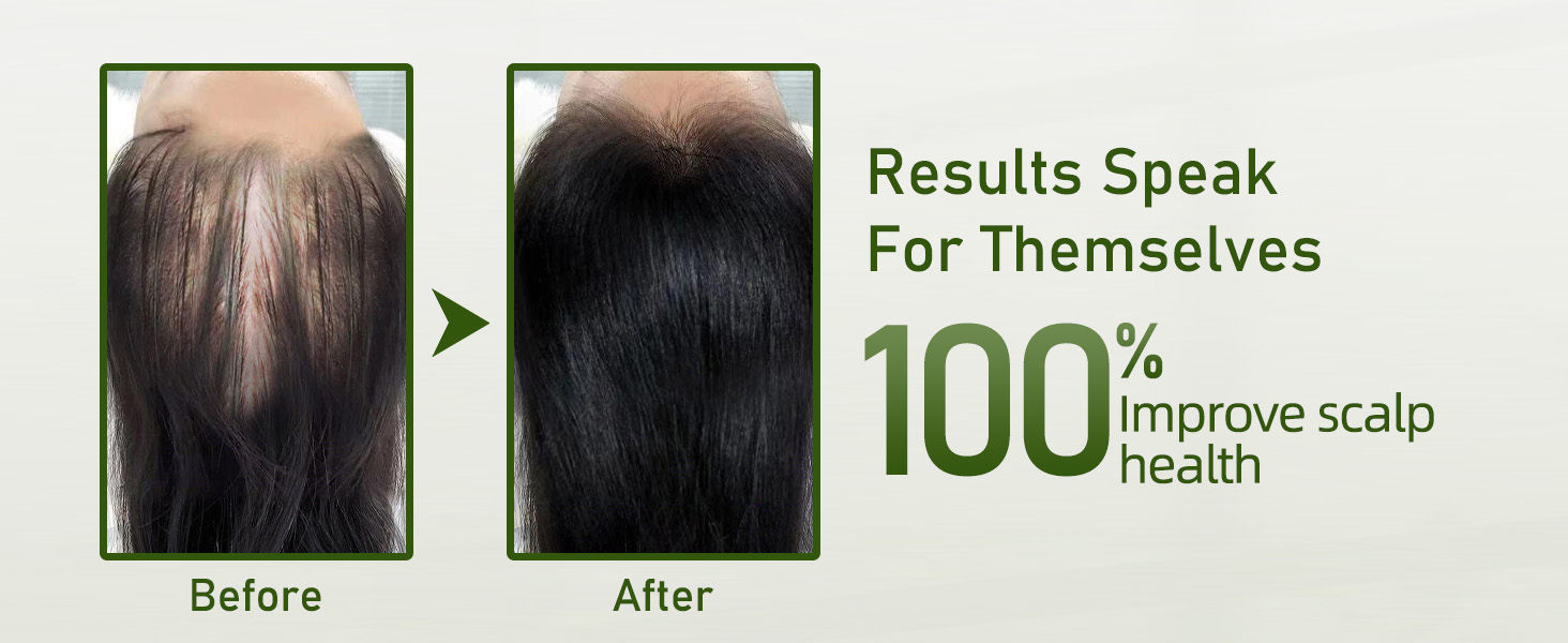Rosemary Shampoo for Hair Growth