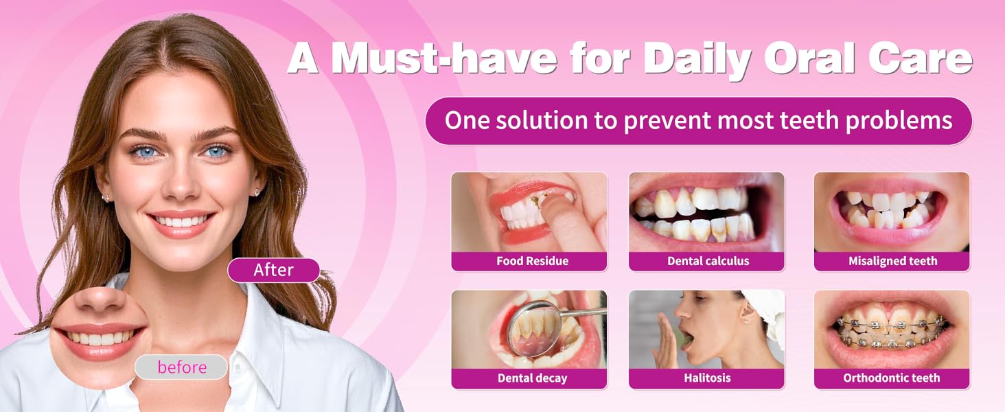 A Must-have for Daily Oral Care One solution to prevent most teeth problems