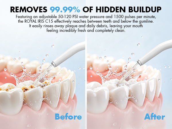 power dental flossers