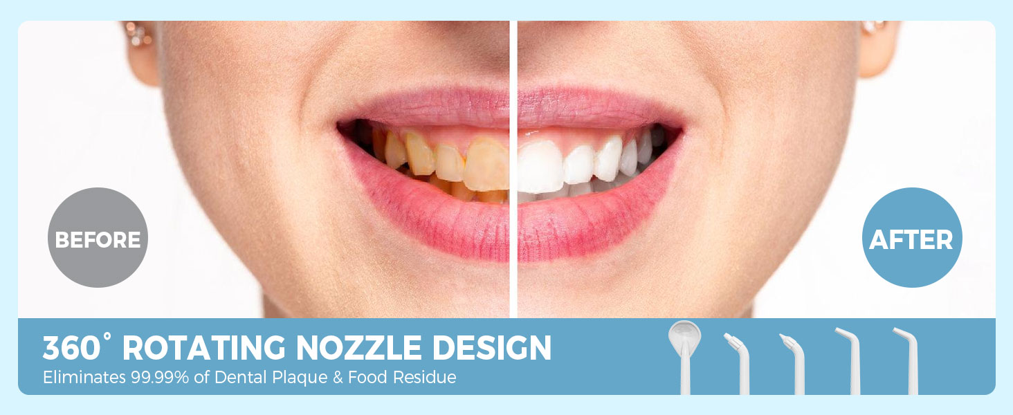cordless water flosser