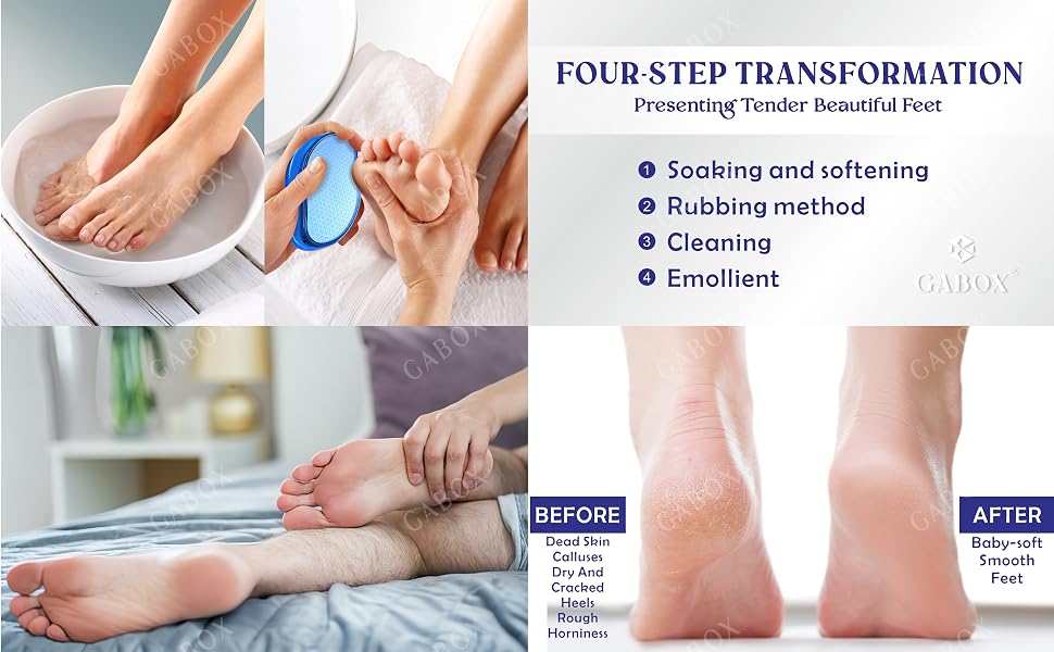 GABOX foot scrubber (FF-05A)