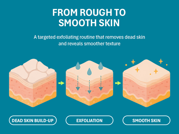 Heel mask formulated to soften rough calluses