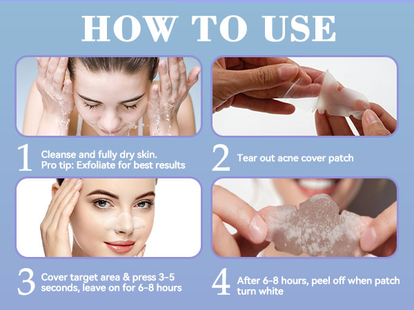 Nose Pore Patches