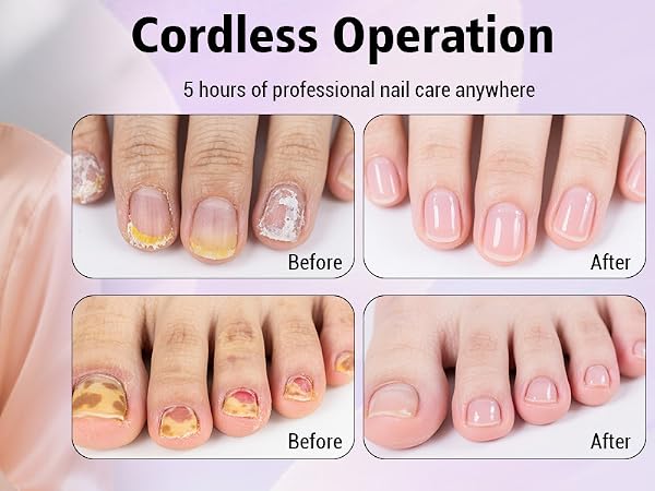 nail drill