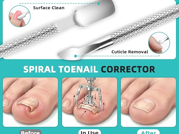 nail kit
