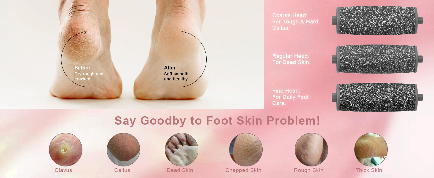 electric feet callus remover