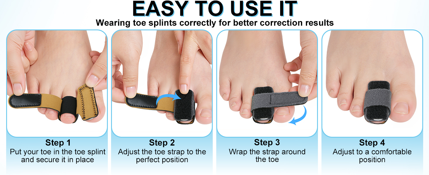 Hammer Toe Straightener