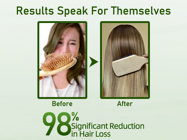Rosemary Shampoo for Hair Growth