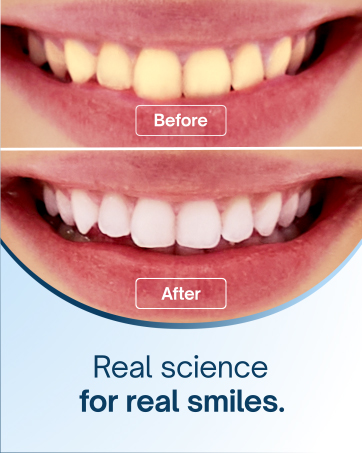 MySweetSmile Teeth Whitening Products have been recommended by The Guardian newspaper