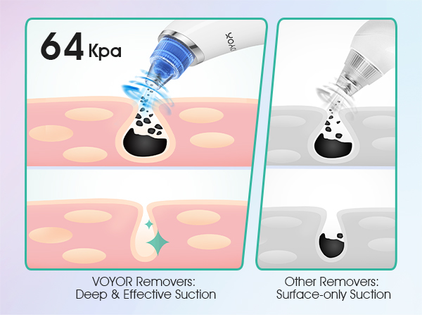 Blackhead Remover Pore Vacuum