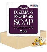 Eczema Soap Bar for Face and Body – All Natural Dermatitis, Psoriasis Treatment for Dry Itchy Sen...
