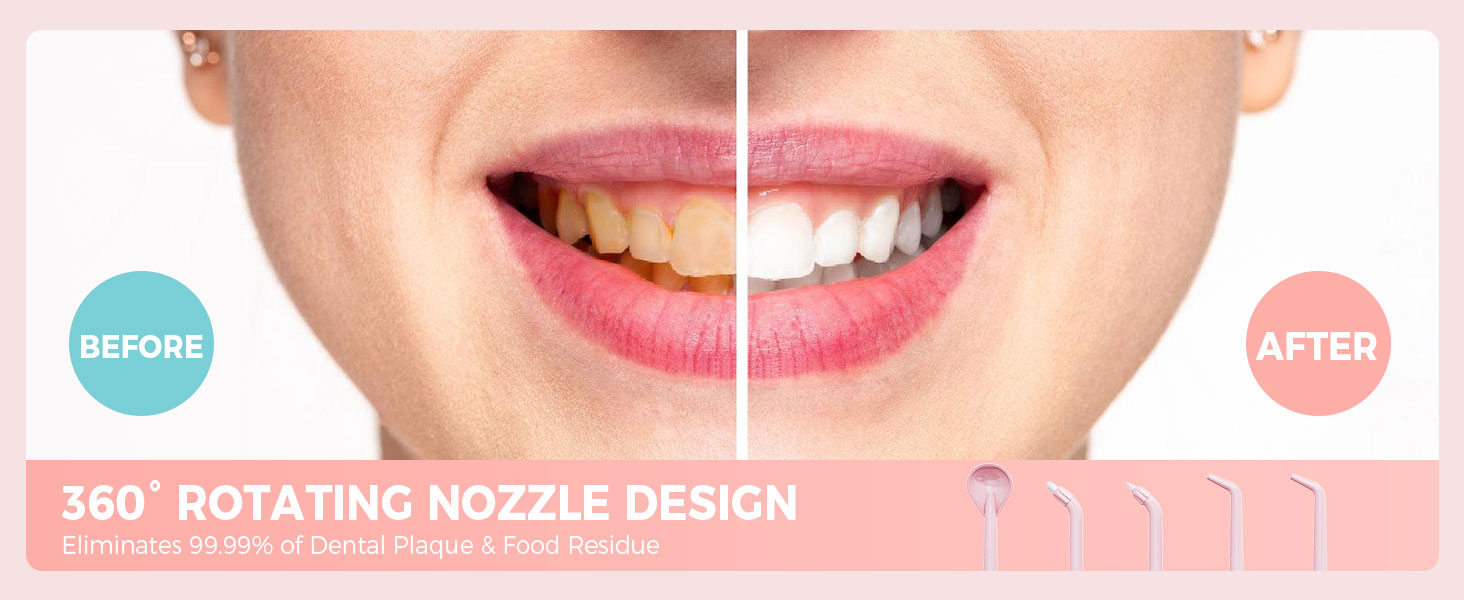 irrigador dental