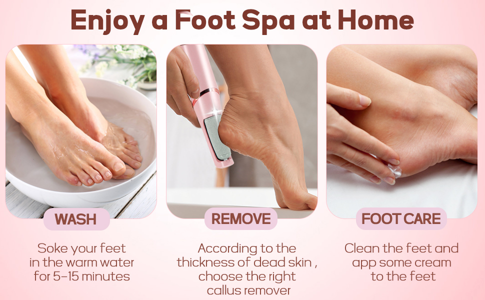 Callus Remover for Feet