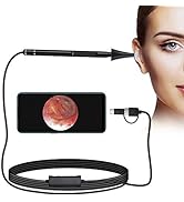 Jiusion 3.9mm Ultra-Thin Portable USB Digital Otoscope Camera with Carrying Case, HD 720P 6 LED V...