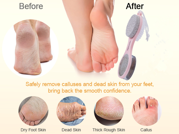 Foot Scrubber Brush with Pumice Stone for Feet, 5-in-1
