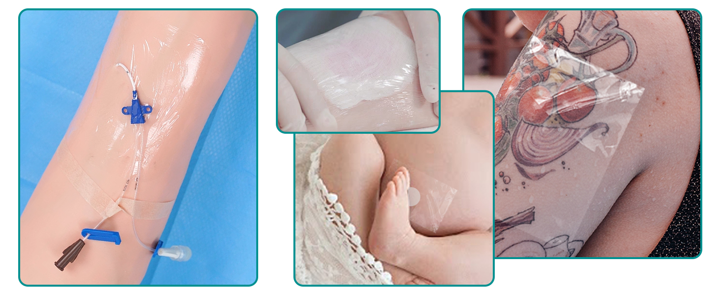 transparent film dressing