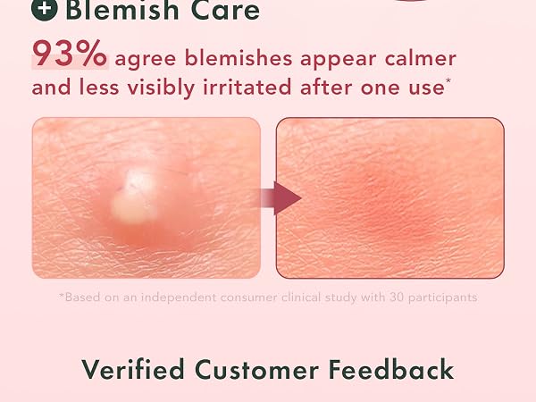 Rael, pimple patches, acne patches, pimple patches for face, Miracle Invisible Spot Cover hydrating