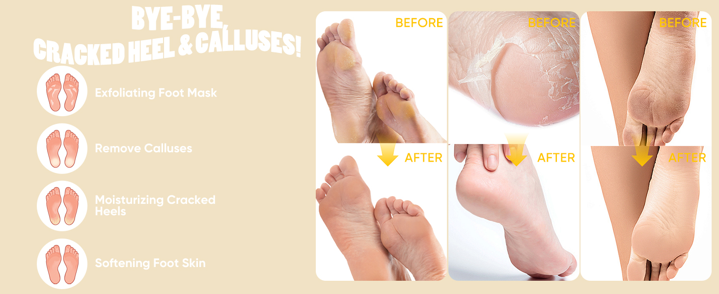 foot peeling mask