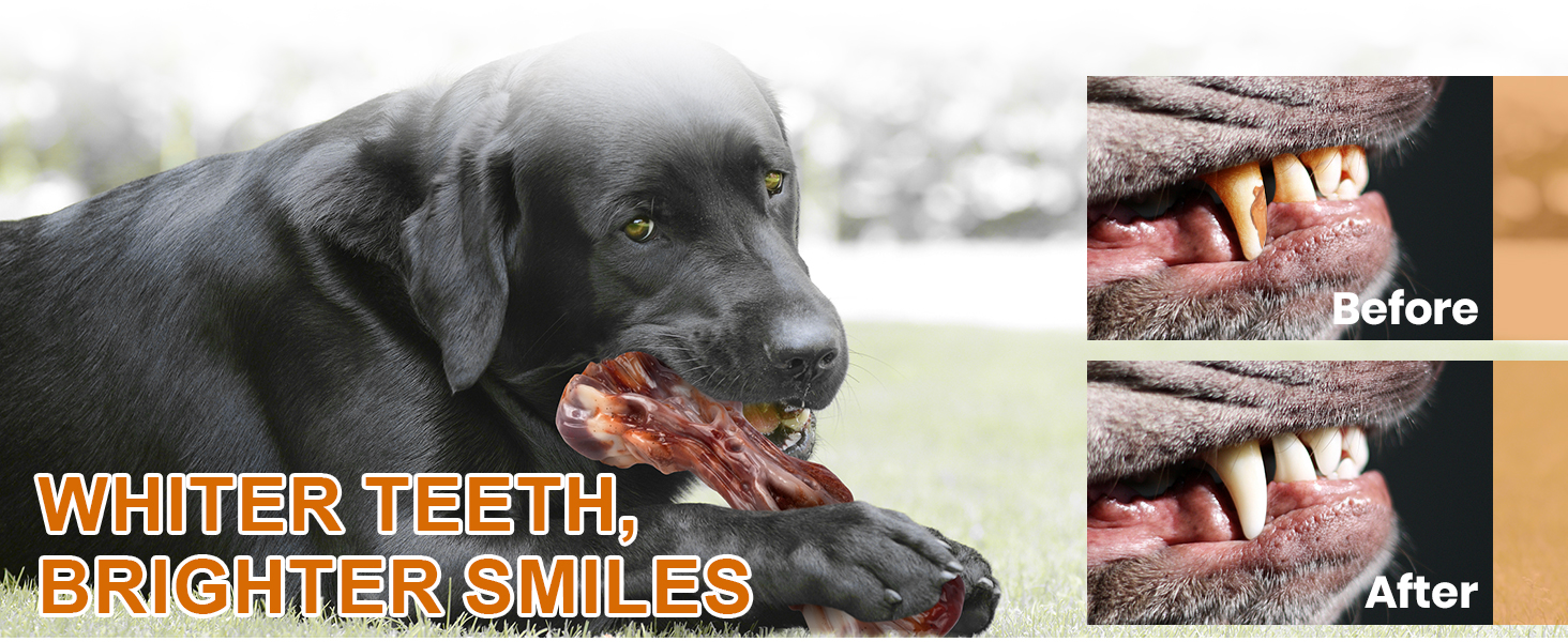 WHITER TEETH, BRIGHTER SMILES