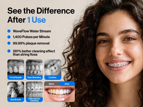 usmile water flosser