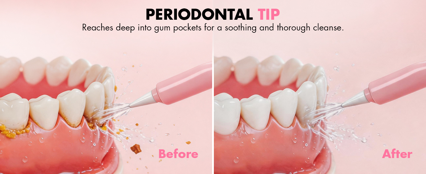 electric flosser for teeth