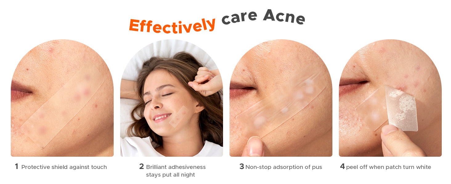 large pimple patches