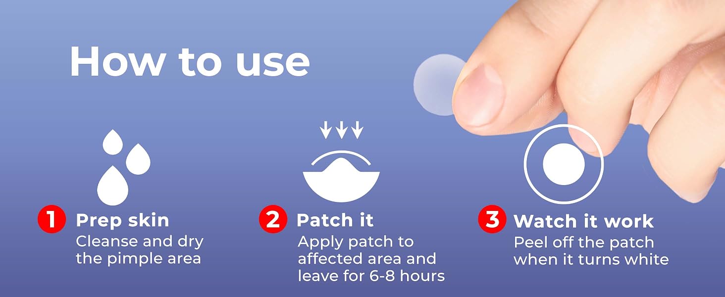 pimple patch, pimple patches, acne patches, pimple patches for face, acne treatment, acne