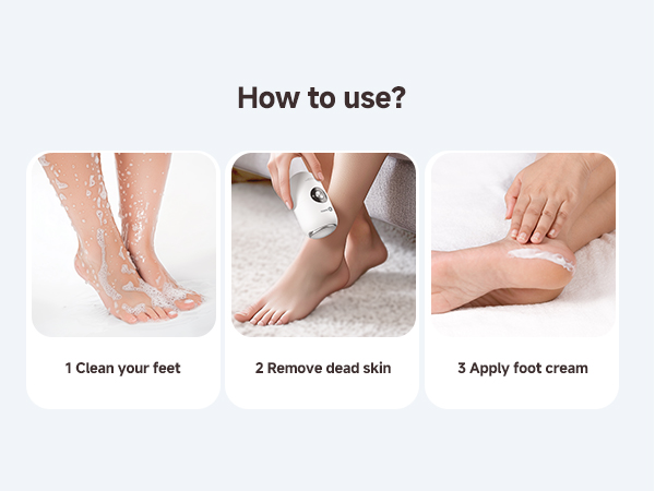 electric foot callus remover