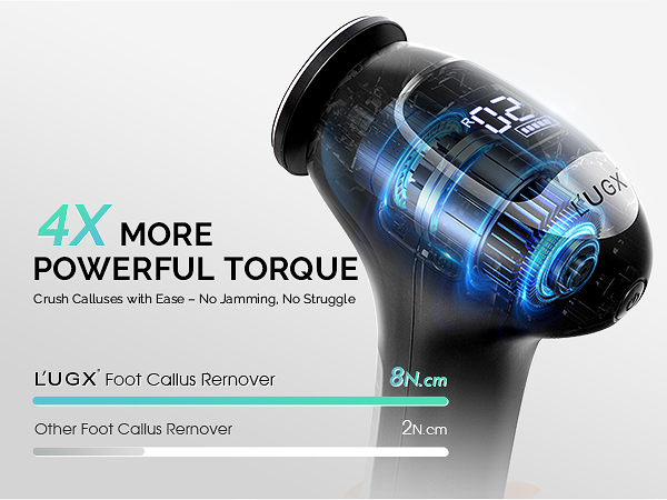 electric foot callus remover