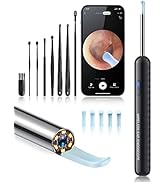 Loyker Ear Wax Removal Tool Camera, FSA HSA Eligible, Ear Cleaner with 1080P Camera, Earwax Remov...