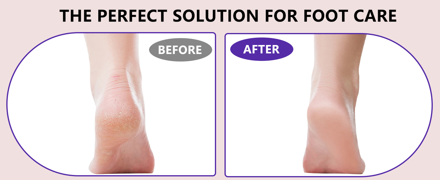 foot scrubbers