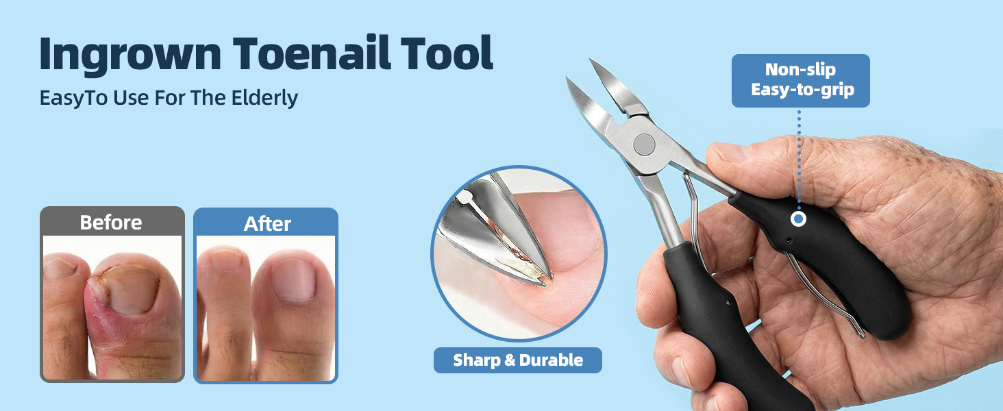 ingrown toenail tool