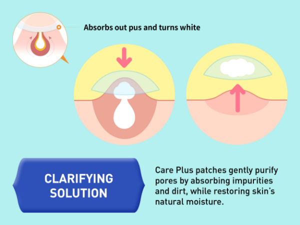 mighty patch pimple patch hero pimple patch