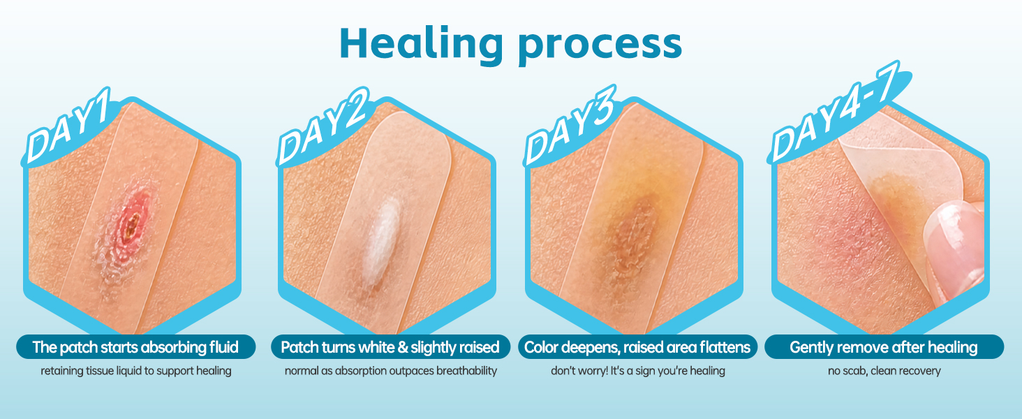 Healing process