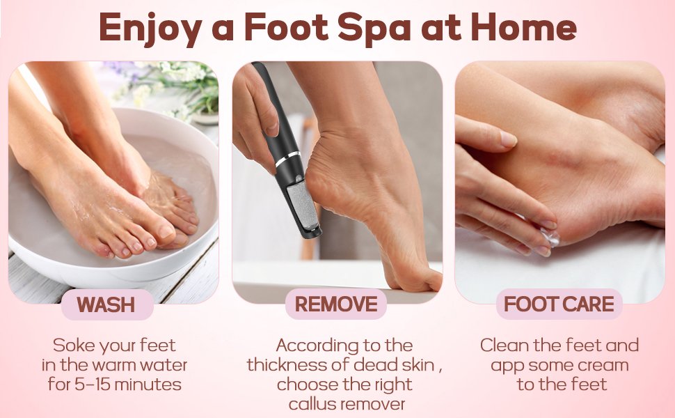 Electric Foot Callus Remover