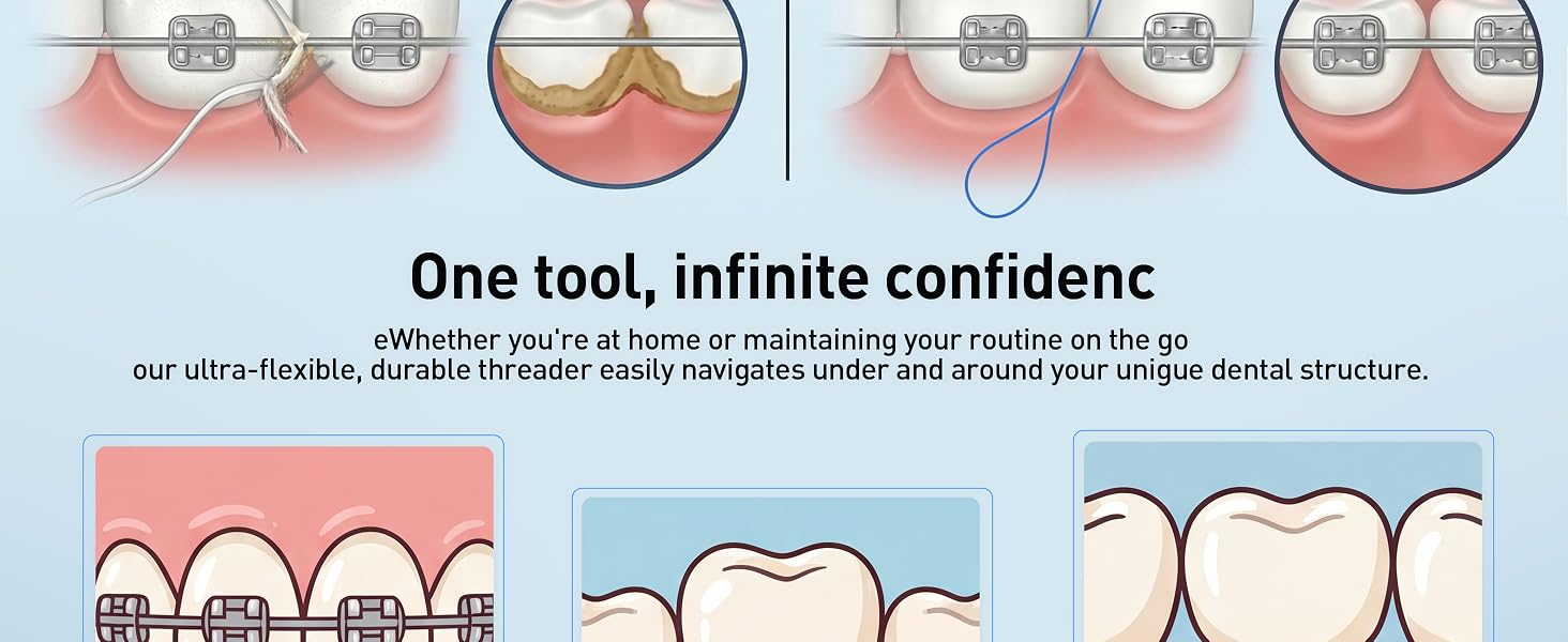 dental threaders