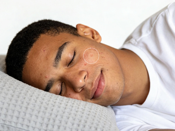 Overnight Care