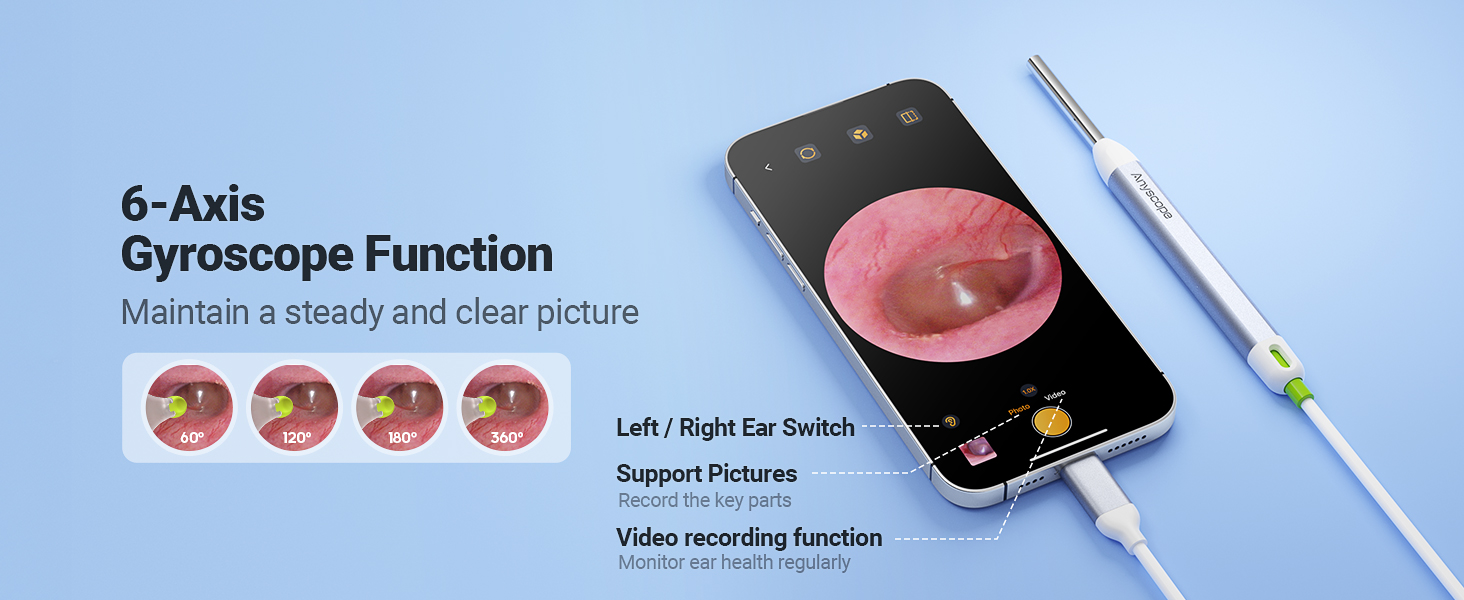 otoscope