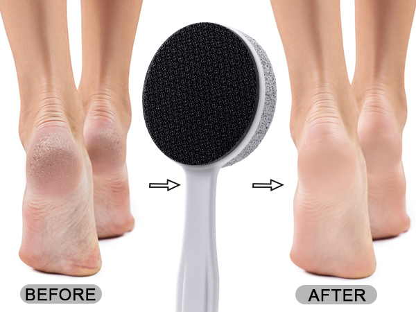 Double Sided Nano Glass and Pumice Stone for Feet Callus Remover