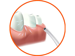 travel, portable, pressure clean, water flosser, flossing, floss head