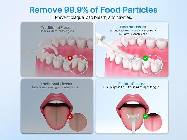 Voraiya Electric Flosser for Teeth