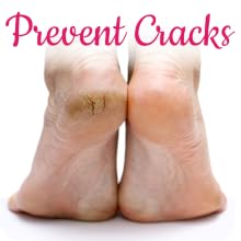 Prevent Cracks
