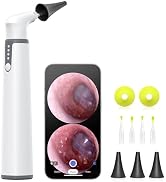 Wireless Otoscope with Gyroscope,AnyScope Ear Camera with Dual View, 3.9 mm Otoscope with Light, ...