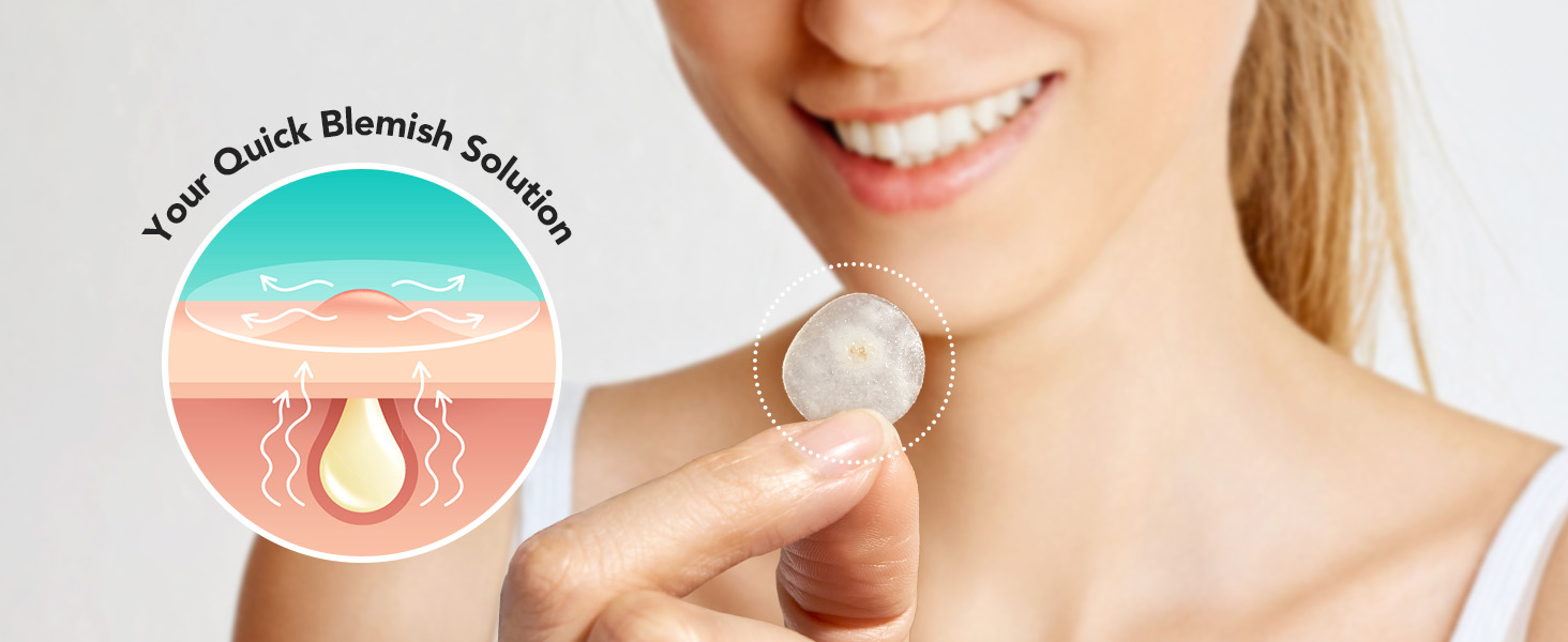 Your Quick Blemish Solution